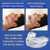 SilentSleep Anti-Snoring Device